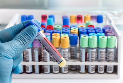 Anytime Is a Wonderful Time to Have Your Thyroid Tested! - Anytime Is a Wonderful Time to Have Your Thyroid Tested!