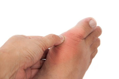 Q: Will the I-Burn help with gout? - Q: Will the I-Burn help with gout?
